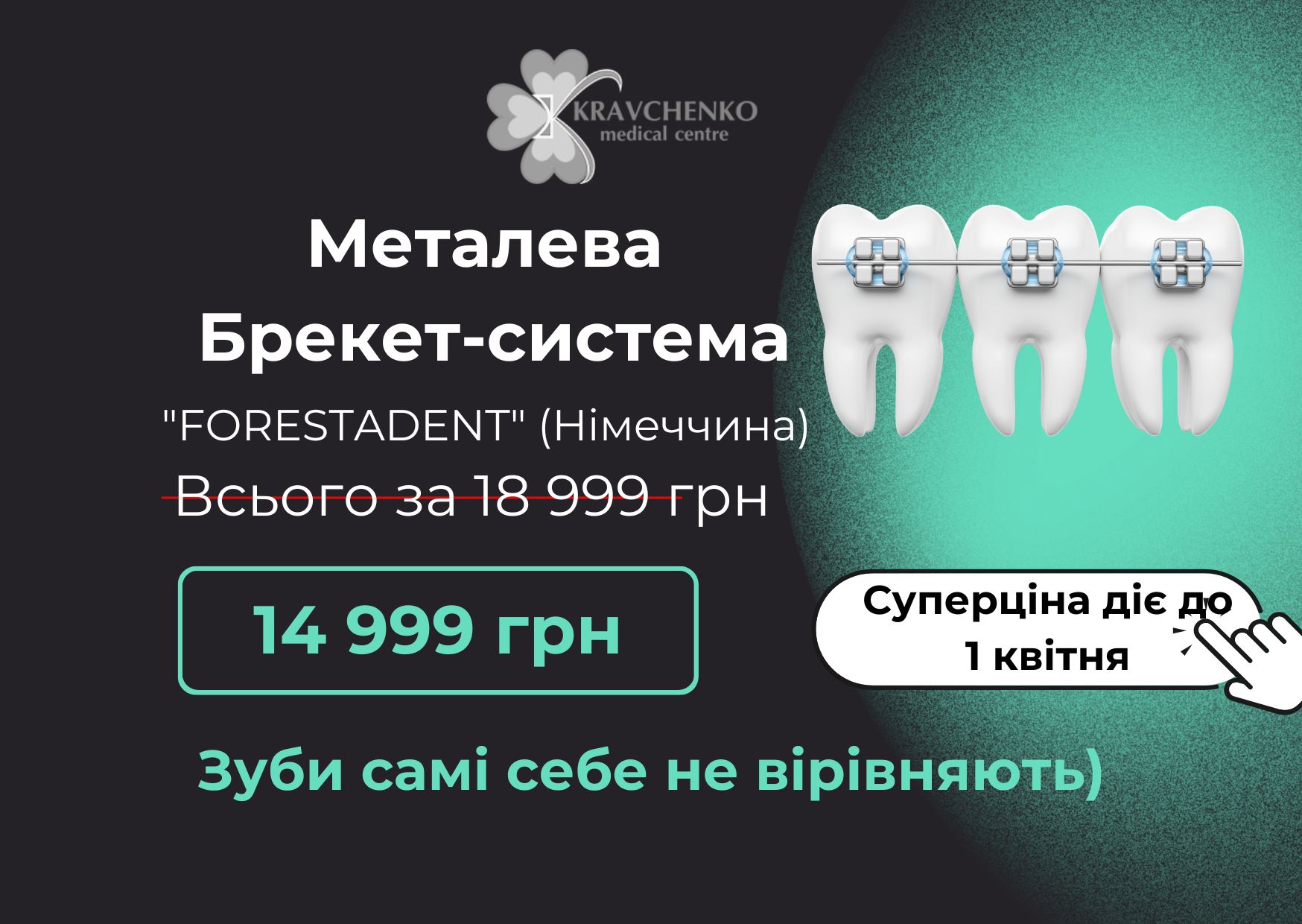 Встановлення металевої брекет-системи від німецького виробника